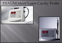 DIAGNOdent Laser Cavity Detector Dental Louisville Kentucky